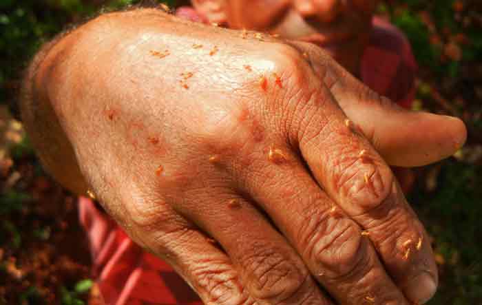 termites hand human